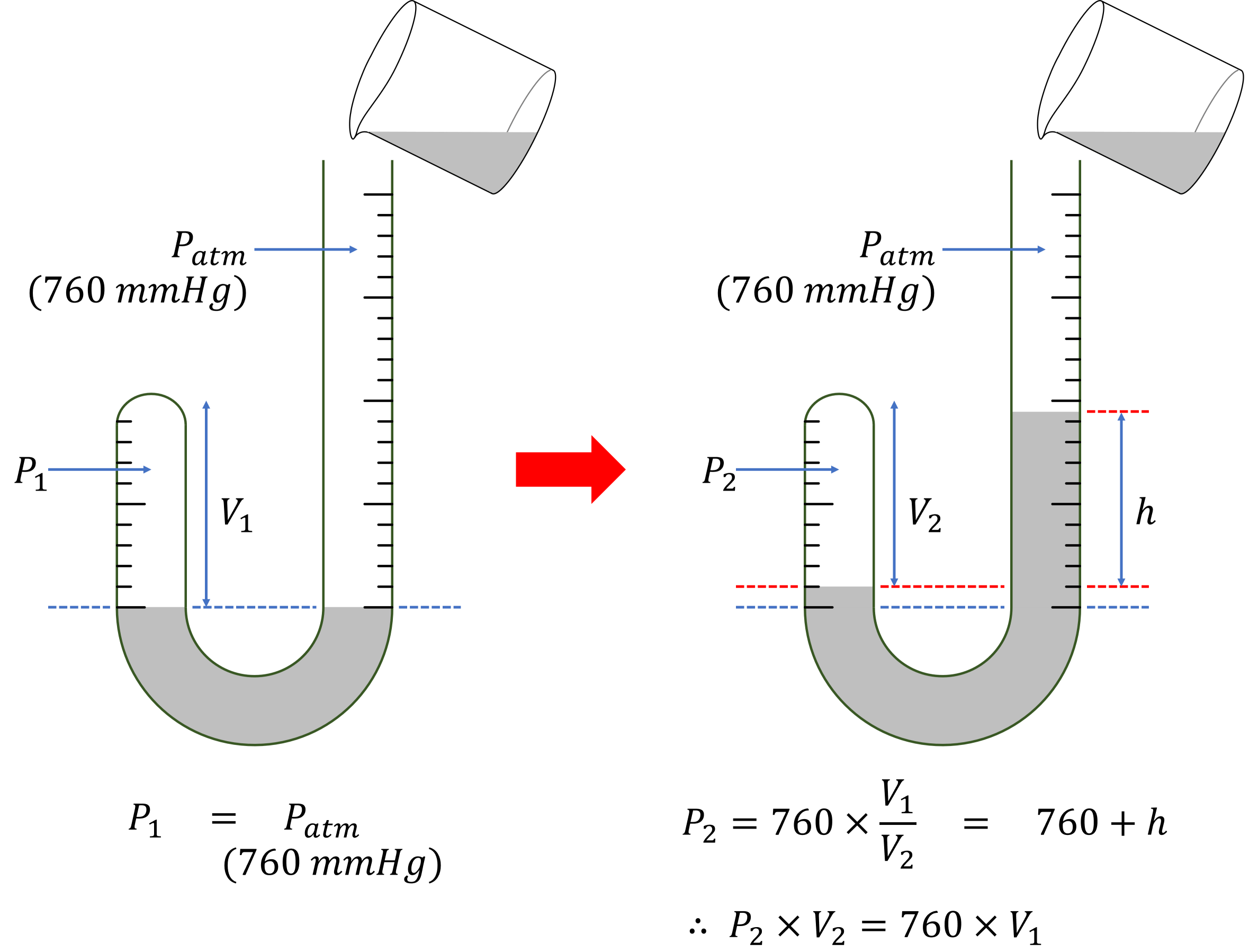 Boyle’s J Tube